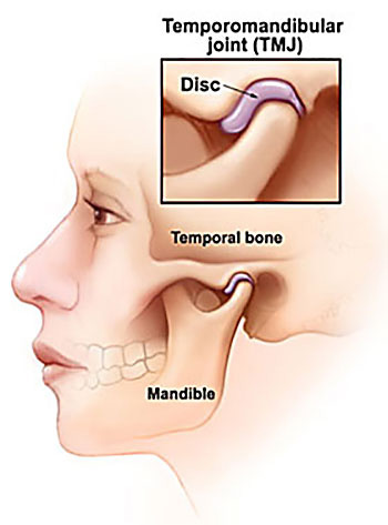 TMJ/TMD treatment illustration