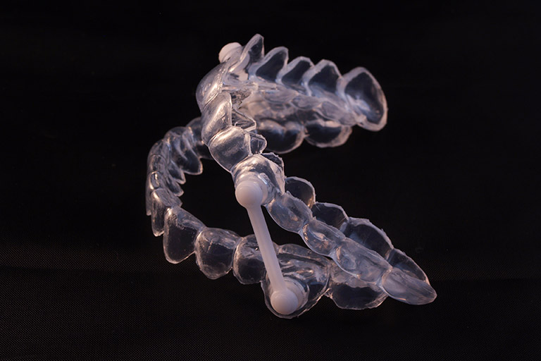 Close up oral appliance